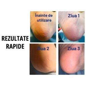 Set complet pentru refacerea călcâielor crăpate – HeelRecover - imagine 4